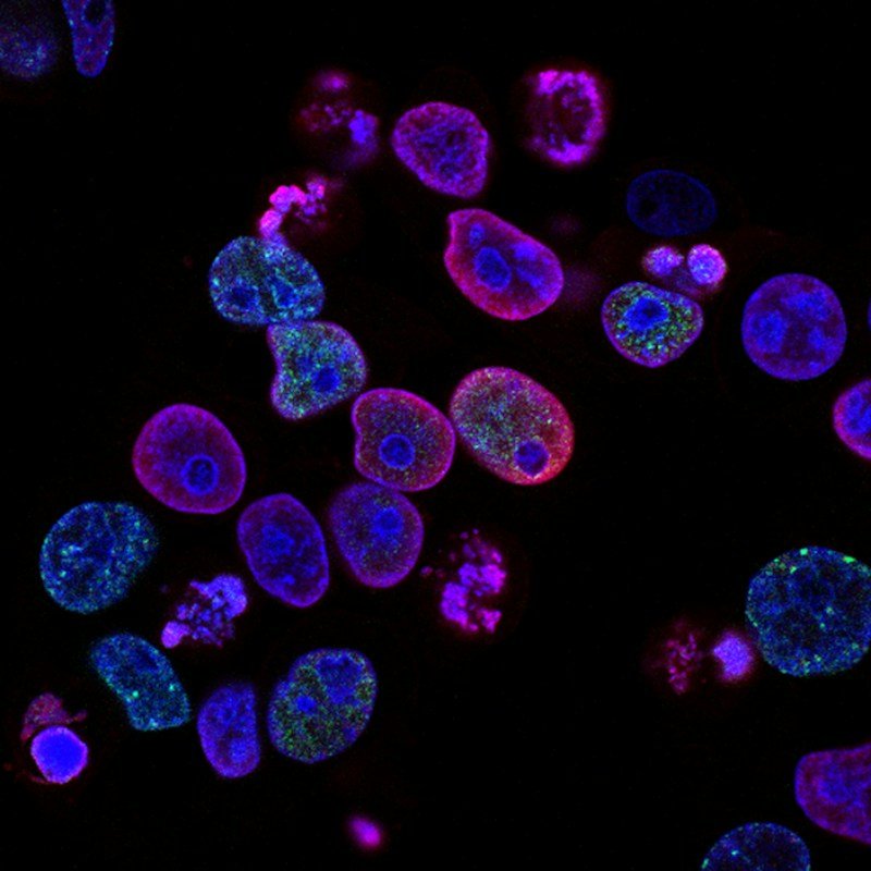 Therapeutic Peptides: Why Demand Is Growing and What Makes Them Complex to Make